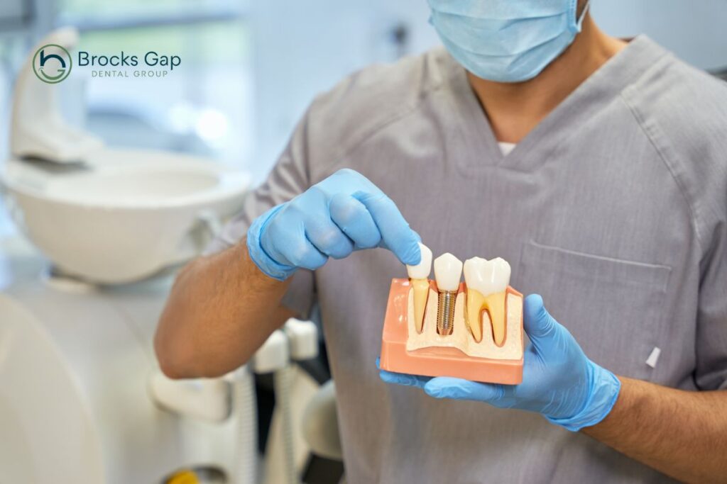 dental implants in hoover